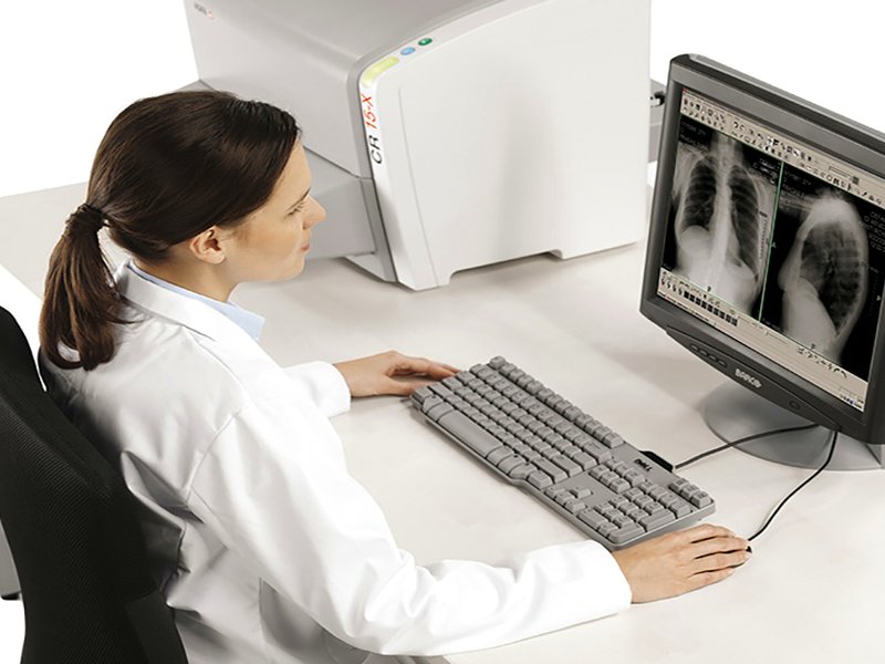 Poste de lecture d'images médicales avec un lecteur de plaques Agfa